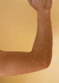 Elbow