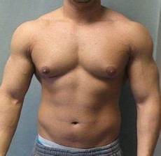 Male Nipple