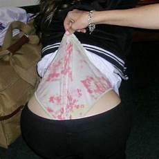 Wedgie